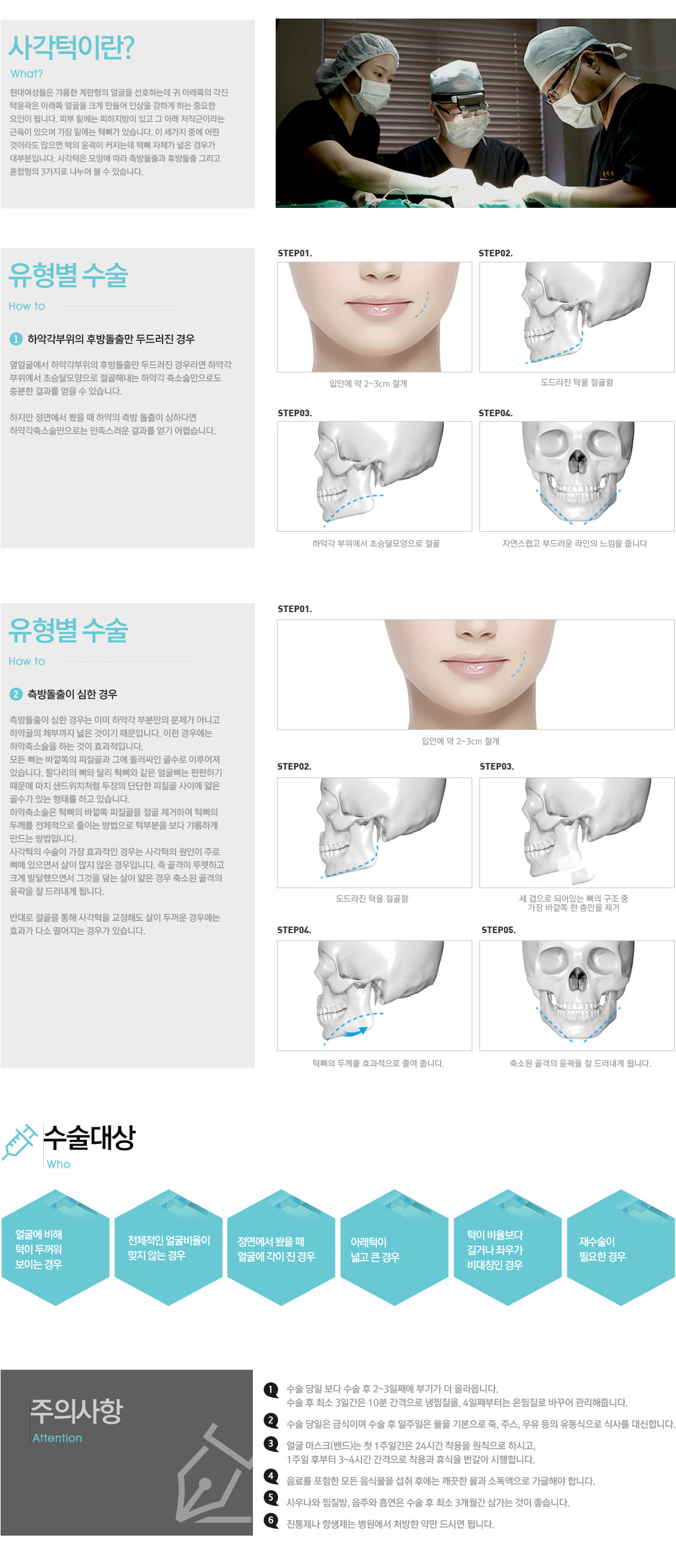 사각턱