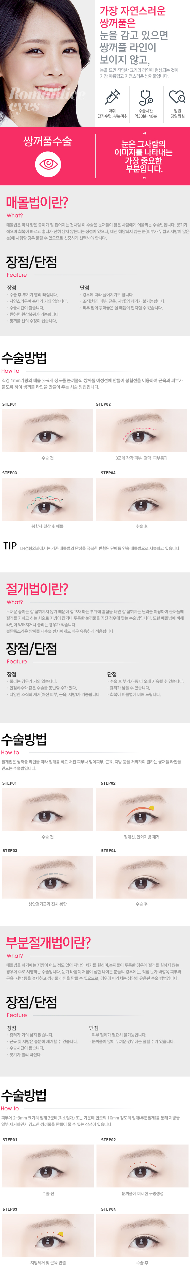 쌍꺼풀수술