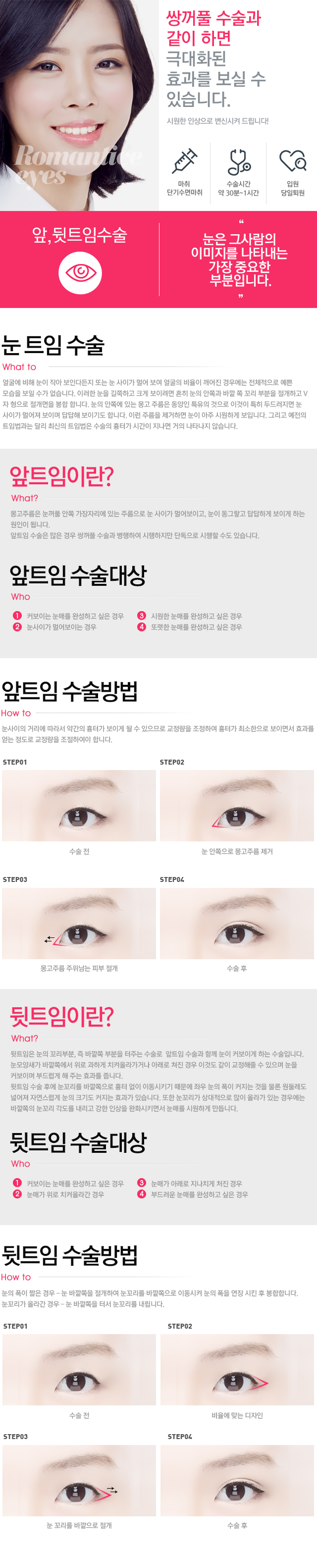 앞,뒷트임