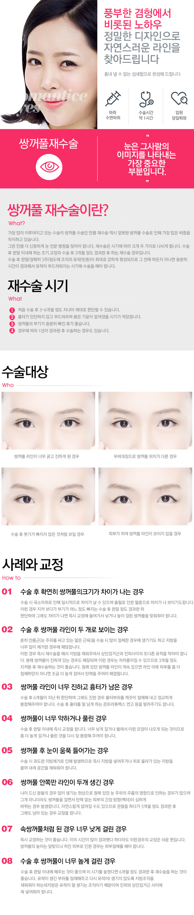 쌍꺼풀 재수술
