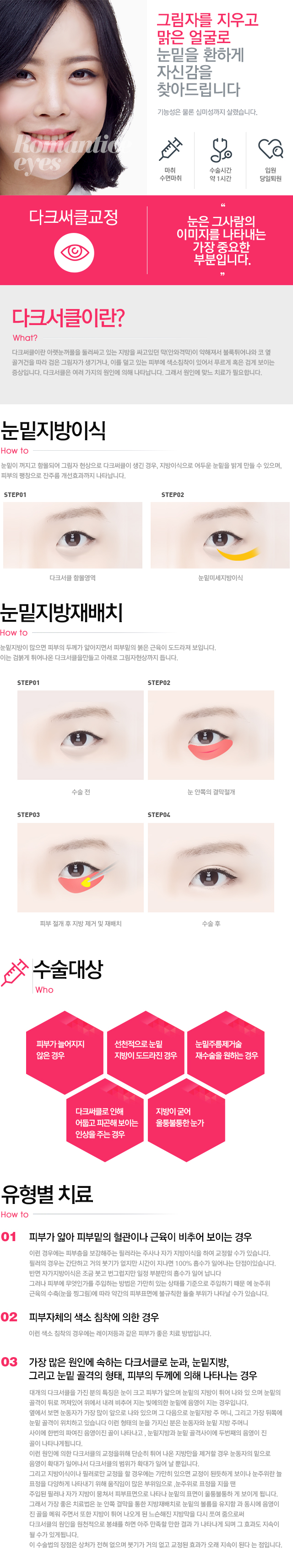 다크서클의 교정