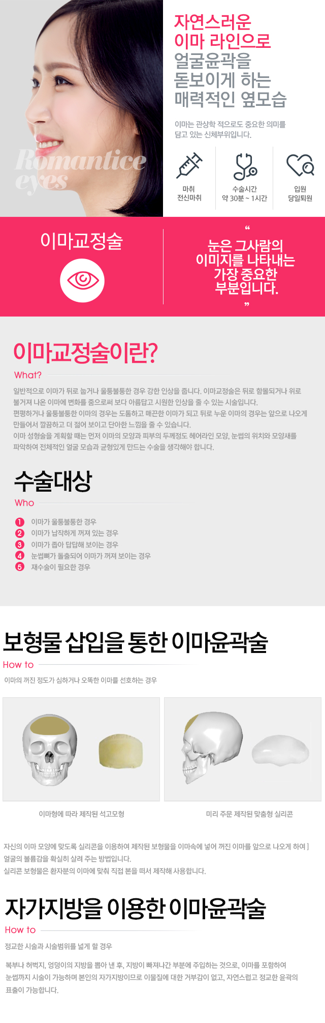 이마교정술