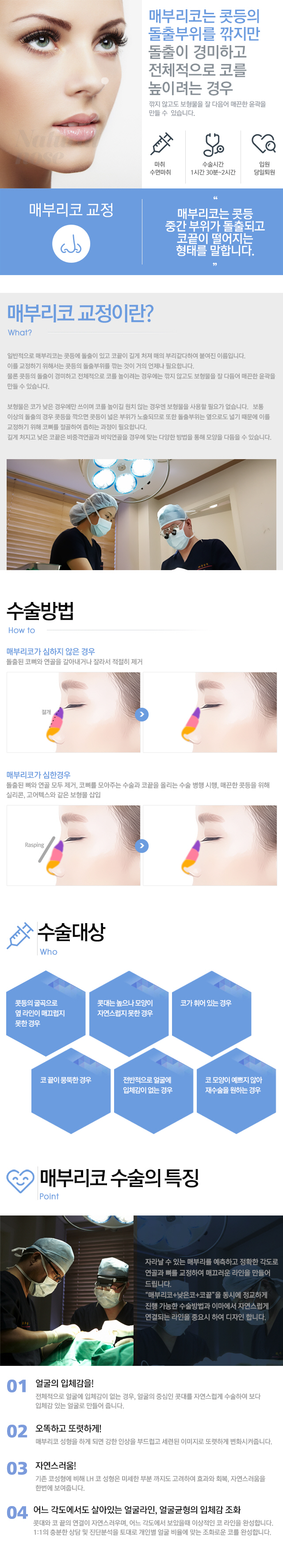 매부리코의 교정