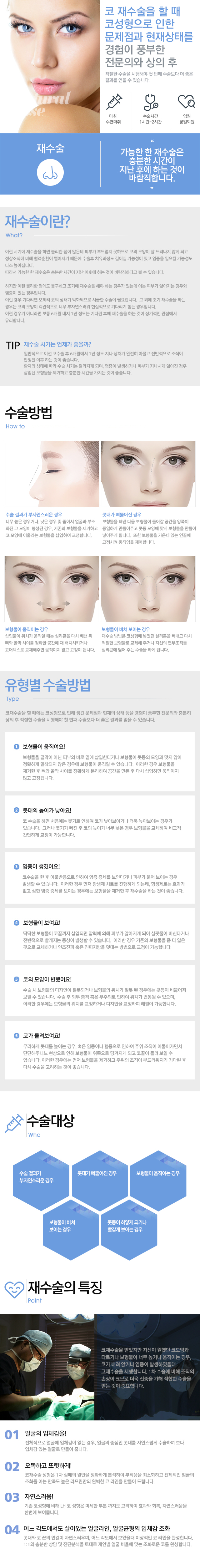재수술