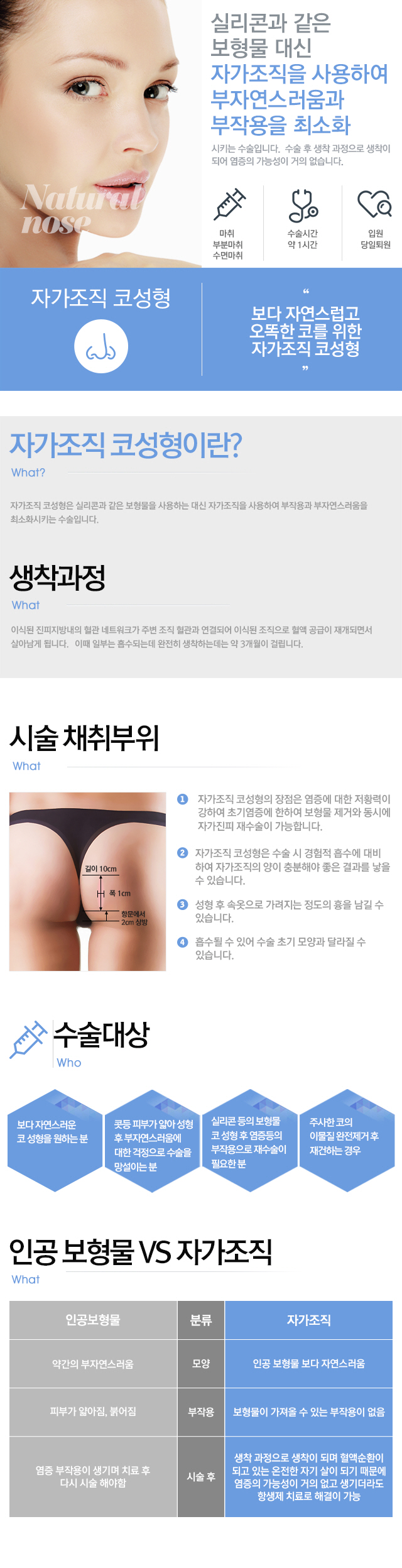 자가조직 코성형