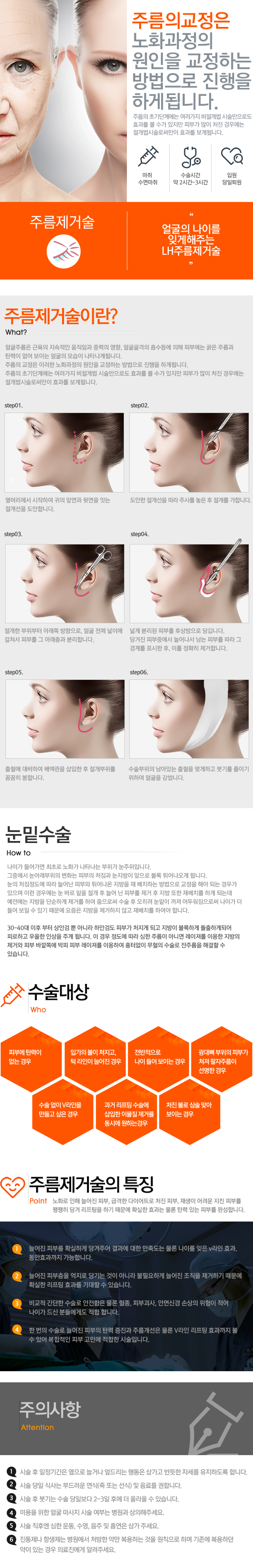 주름제거술