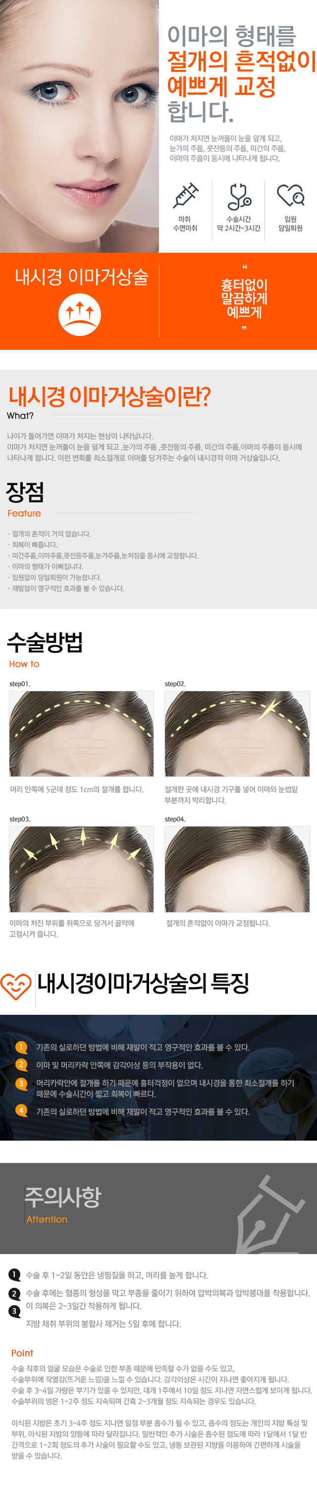 내시경이마거상술