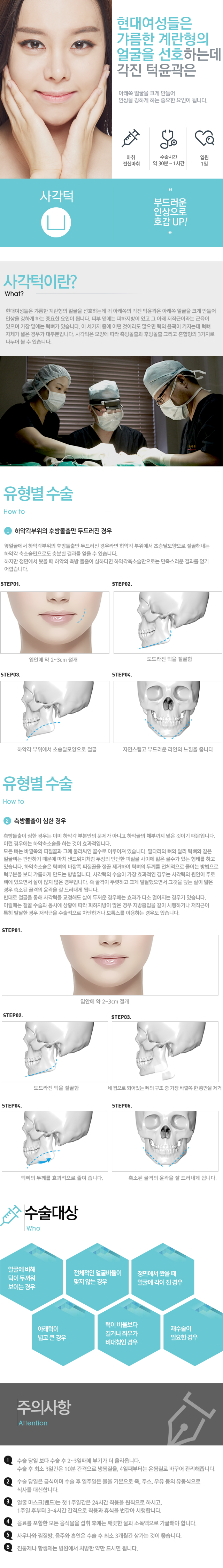 사각턱