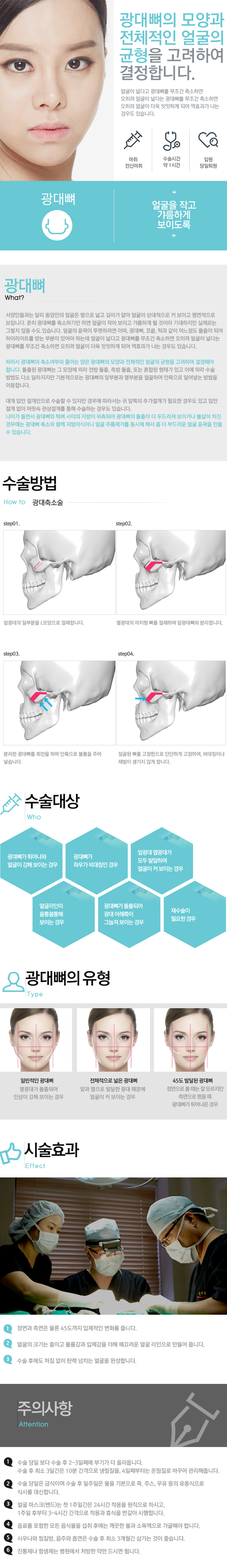 광대뼈