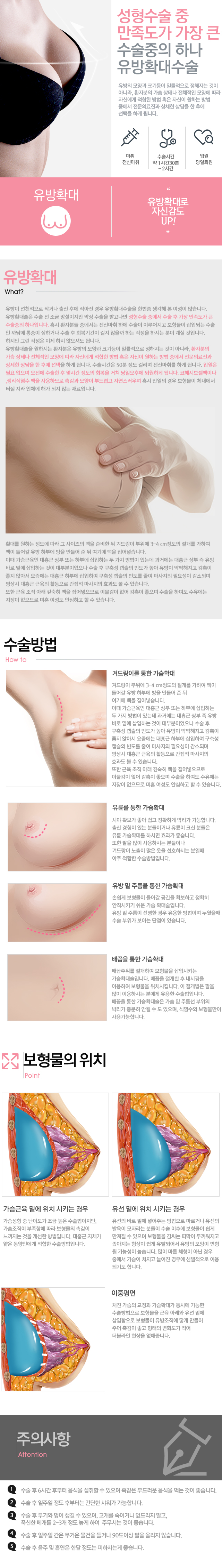 유방확대