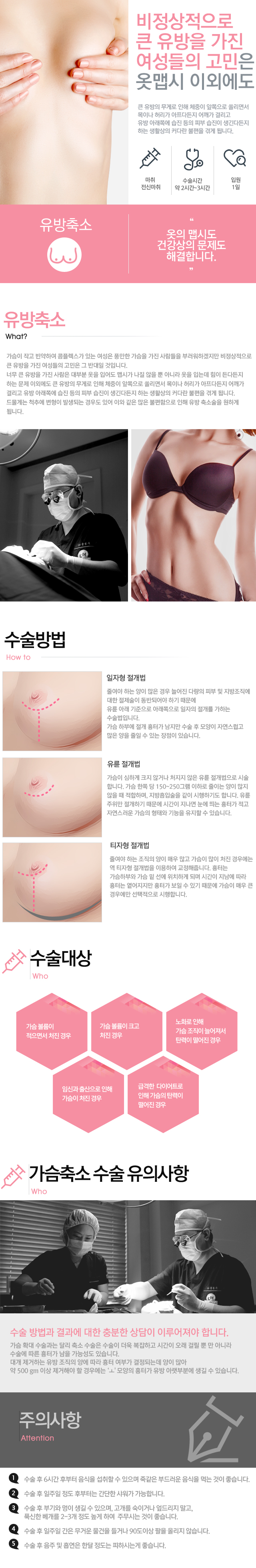 유방축소