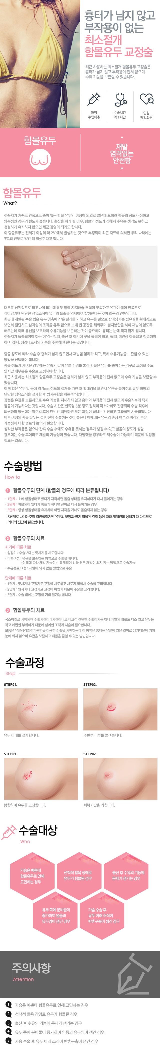 함몰유두