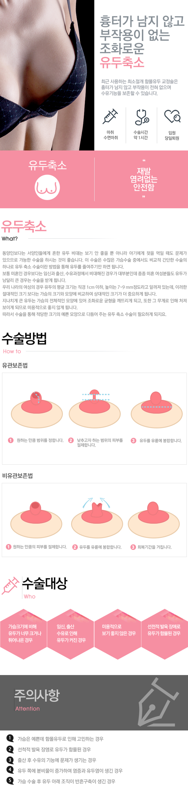 유두축소