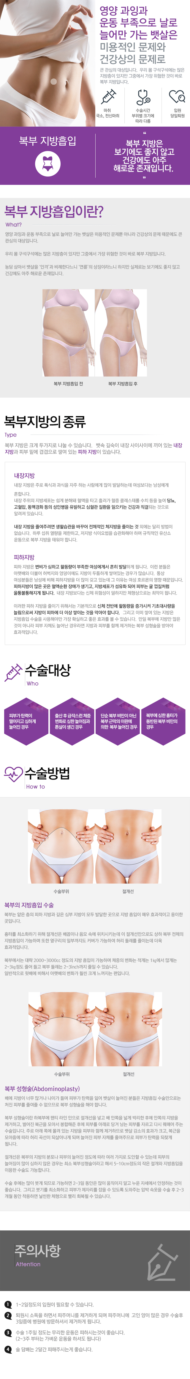 복부 지방흡입