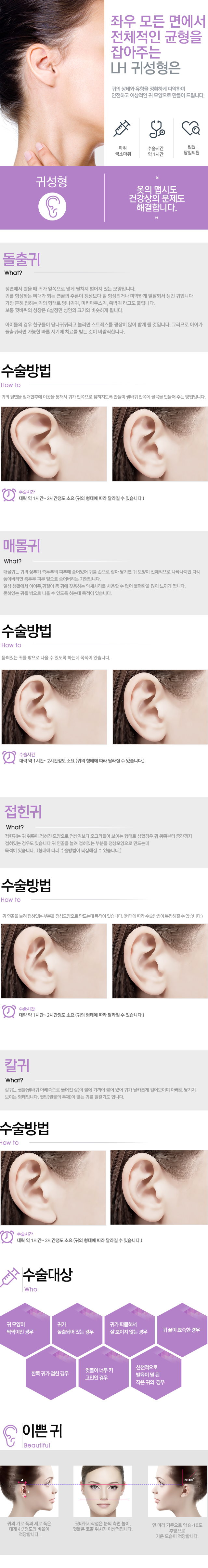 귀성형
