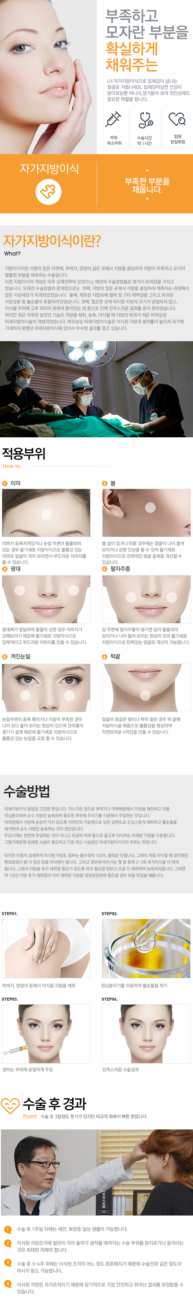자가지방이식