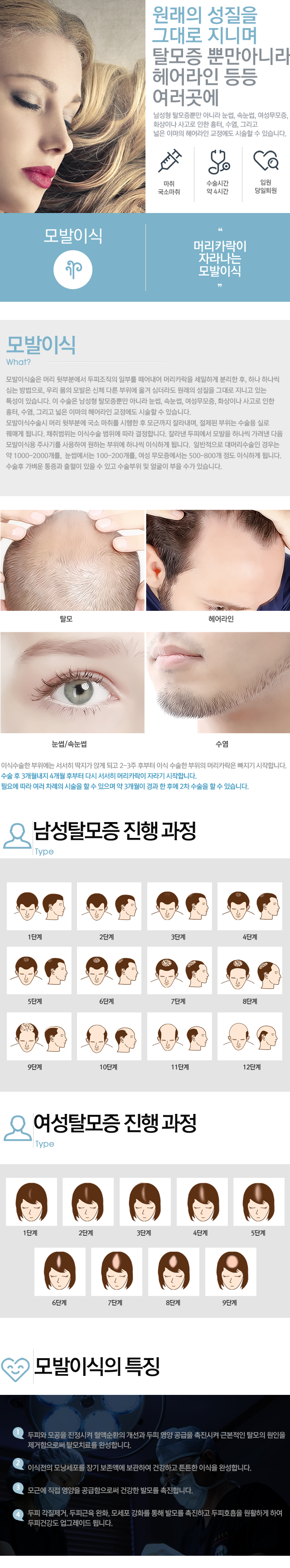 모발이식